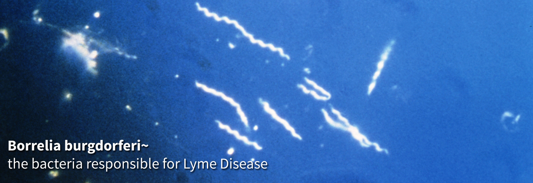 The Summer's Bane - Lyme Disease